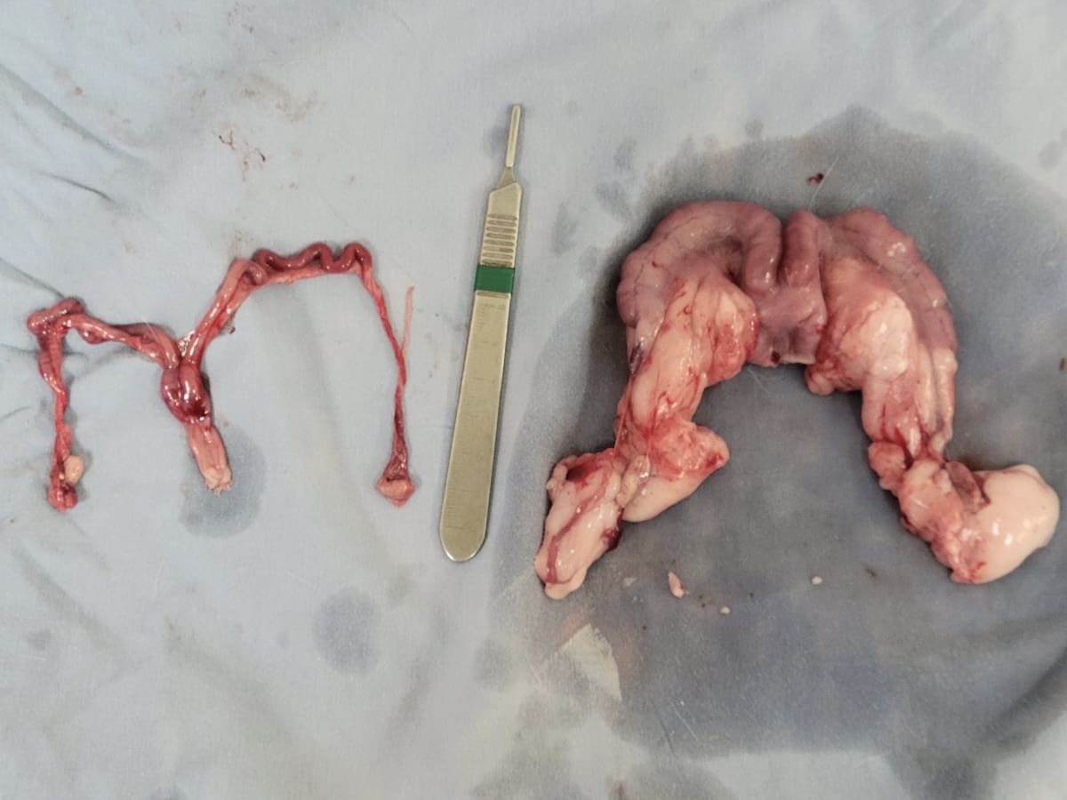 Case Study: A Tale of Two Uteruses