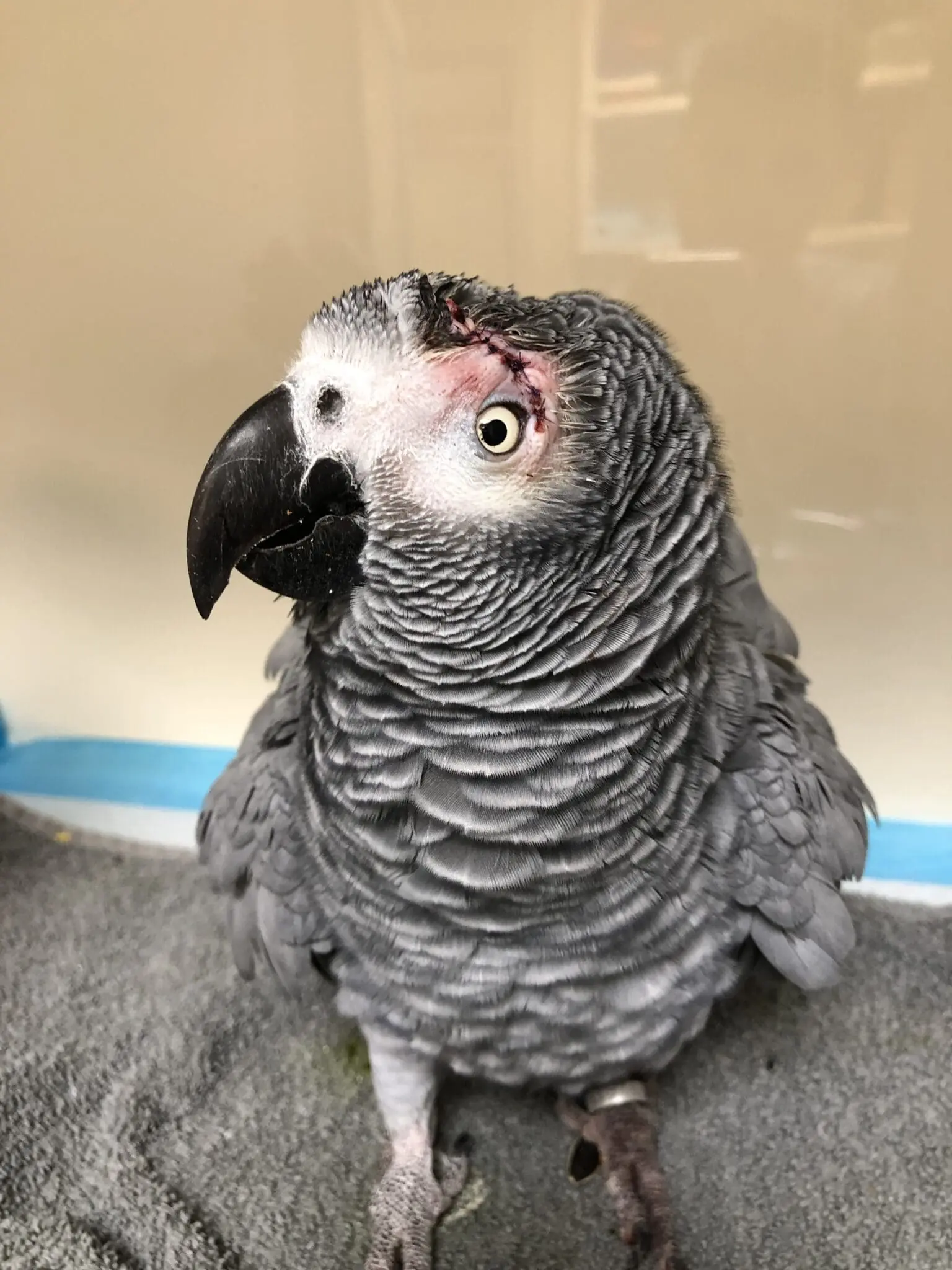 Case Study: An Eye-Opening Growth Removal
